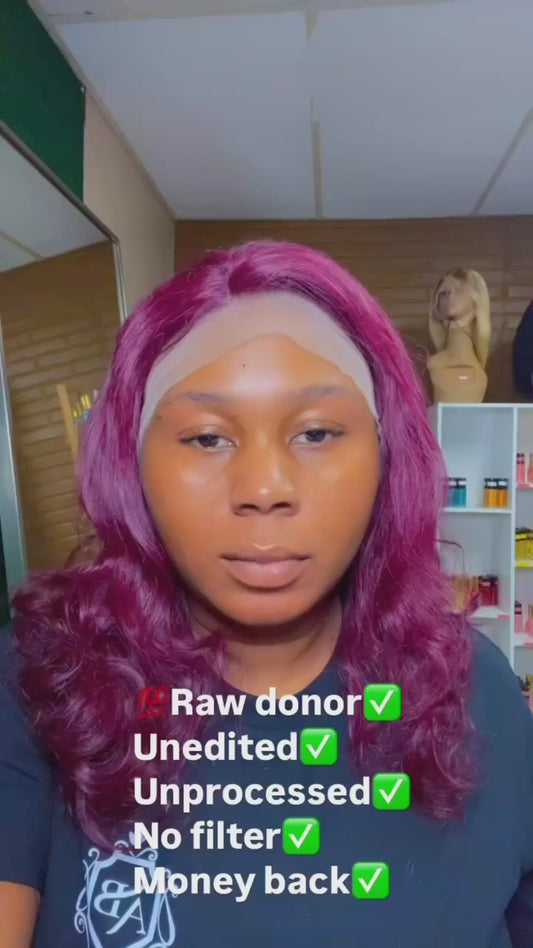 Raw donor hair